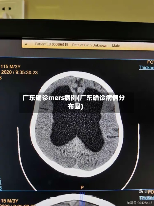 广东确诊mers病例(广东确诊病例分布图)-第2张图片